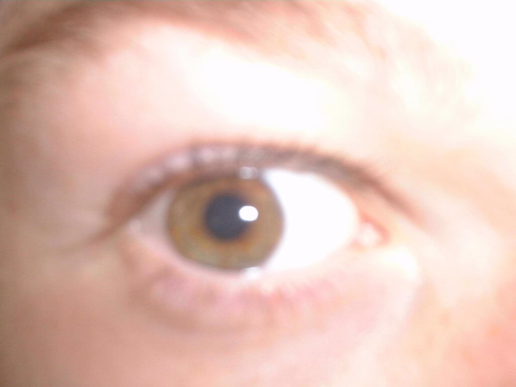 Doug's eye
